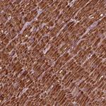 NDUFB10 Antibody in Immunohistochemistry (Paraffin) (IHC (P))