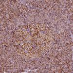 NDUFB10 Polyclonal Antibody