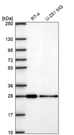CHMP3 Antibody in Western Blot (WB)