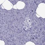 MLCK Polyclonal Antibody