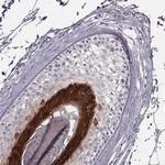 FABP9 Polyclonal Antibody