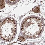 DEDD Antibody in Immunohistochemistry (Paraffin) (IHC (P))