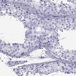 SPANXD Polyclonal Antibody