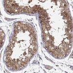 PAIP1 Antibody in Immunohistochemistry (Paraffin) (IHC (P))