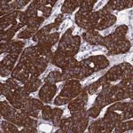 FAM8A1 Polyclonal Antibody