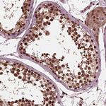 NSD1 Polyclonal Antibody