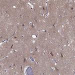 Erc2 Antibody in Immunohistochemistry (Paraffin) (IHC (P))