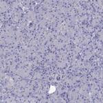 Erc2 Polyclonal Antibody