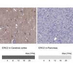 Erc2 Antibody