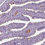 MDH1B Polyclonal Antibody