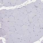 CCL27 Antibody in Immunohistochemistry (Paraffin) (IHC (P))