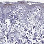 CCL27 Antibody in Immunohistochemistry (Paraffin) (IHC (P))