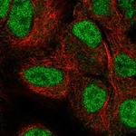 NEIL2 Polyclonal Antibody