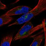 PTPN21 Polyclonal Antibody