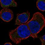 CA095 Polyclonal Antibody