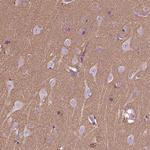 HAGHL Polyclonal Antibody
