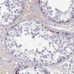 MAGEB2 Antibody in Immunohistochemistry (Paraffin) (IHC (P))