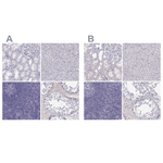 MAGEB2 Polyclonal Antibody