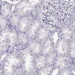 MAGEB2 Antibody in Immunohistochemistry (Paraffin) (IHC (P))