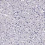 MAGEB2 Antibody in Immunohistochemistry (Paraffin) (IHC (P))