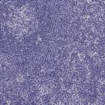 MAGEB2 Antibody in Immunohistochemistry (Paraffin) (IHC (P))