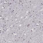 ADAM11 Antibody in Immunohistochemistry (Paraffin) (IHC (P))