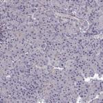 ADAM11 Antibody in Immunohistochemistry (Paraffin) (IHC (P))