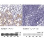 SLC22A6 Antibody
