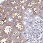 SLC22A6 Antibody in Immunohistochemistry (Paraffin) (IHC (P))