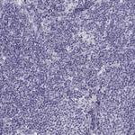 SLC22A6 Polyclonal Antibody