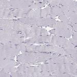 SLC22A6 Antibody in Immunohistochemistry (Paraffin) (IHC (P))