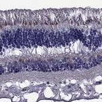 COL9A1 Polyclonal Antibody