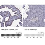 LRRC46 Antibody