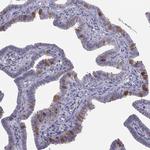LRRC46 Antibody in Immunohistochemistry (Paraffin) (IHC (P))