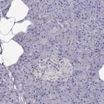 LRRC46 Polyclonal Antibody