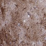 TMEM158 Antibody in Immunohistochemistry (Paraffin) (IHC (P))