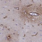 TMEM158 Polyclonal Antibody