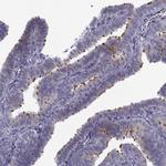 TMEM158 Antibody in Immunohistochemistry (Paraffin) (IHC (P))