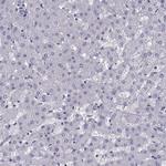 TMEM158 Antibody in Immunohistochemistry (Paraffin) (IHC (P))