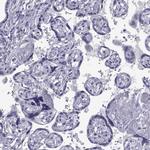 TMEM158 Antibody in Immunohistochemistry (Paraffin) (IHC (P))