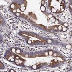 PLEKHB2 Polyclonal Antibody