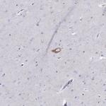 Chromogranin C Antibody in Immunohistochemistry (Paraffin) (IHC (P))