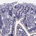 Chromogranin C Antibody in Immunohistochemistry (Paraffin) (IHC (P))