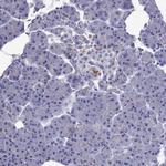 Chromogranin C Antibody in Immunohistochemistry (Paraffin) (IHC (P))