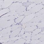 Chromogranin C Antibody in Immunohistochemistry (Paraffin) (IHC (P))