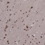 PTOV1 Polyclonal Antibody