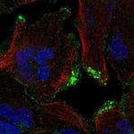 CASKIN2 Polyclonal Antibody