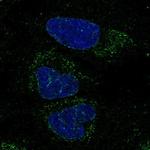 FXYD2-FXYD6 Polyclonal Antibody