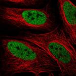 ZMYM3 Polyclonal Antibody