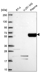 COL9A2 Antibody in Western Blot (WB)